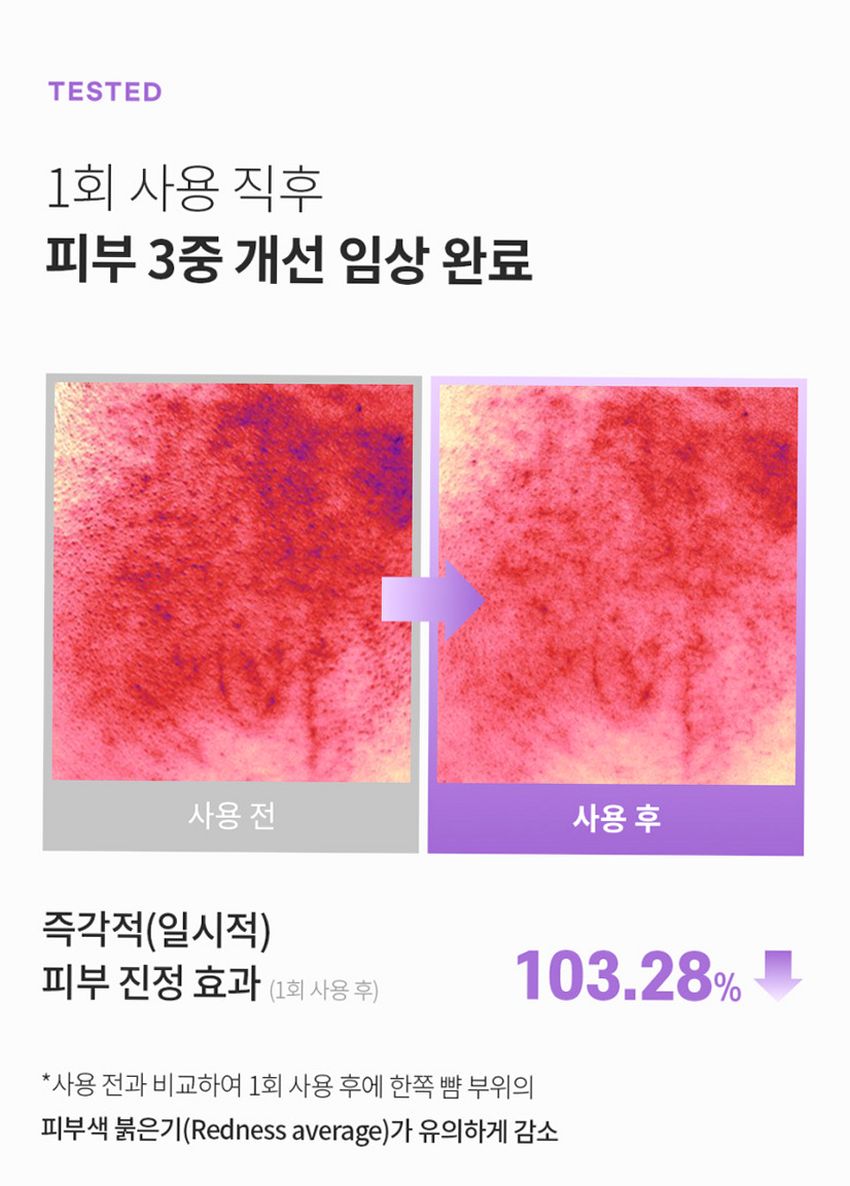 벤튼 구아바 70 스킨 토너 진정 패드 팩(70매) 1개+리필 1개
